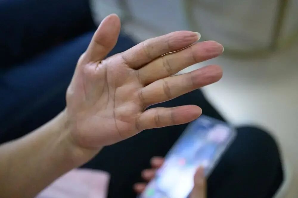 被罕见病“锁住”的高校教师:24年来,“妈妈是我的手和脚” 被罕见病“锁住”的高校教师:24年来,“妈妈是我的手和脚”