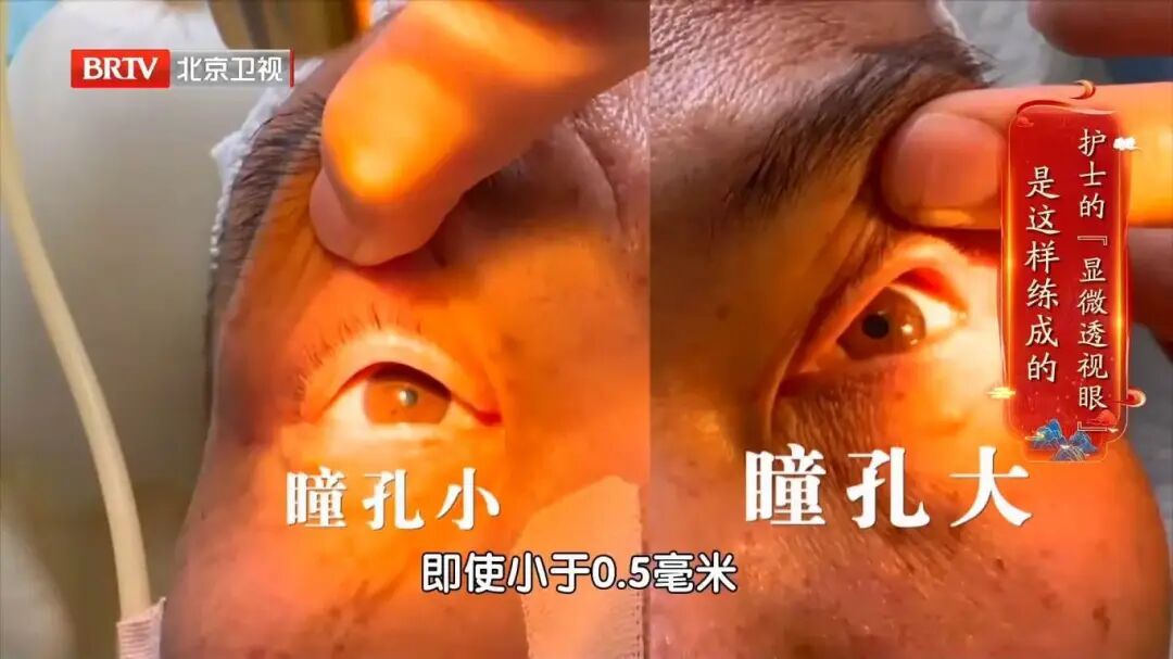 教您30秒发现脑出血信号！快转发给身边人