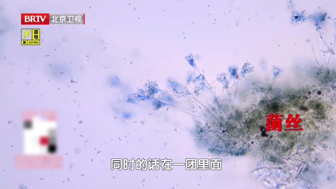 这样的水果，吃多了伤肝肾还致癌，3个不靠谱的处理方法，第1个你肯定做过