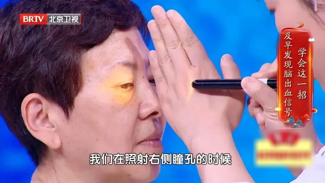 教您30秒发现脑出血信号！快转发给身边人