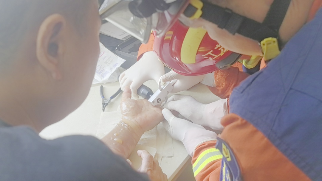 饭没做成反被烫,男子左手“爬满”水泡,无名指上的TA还在持续“加刑” 饭没做成反被烫,男子左手“爬满”水泡,无名指上的TA还在持续“加刑”
