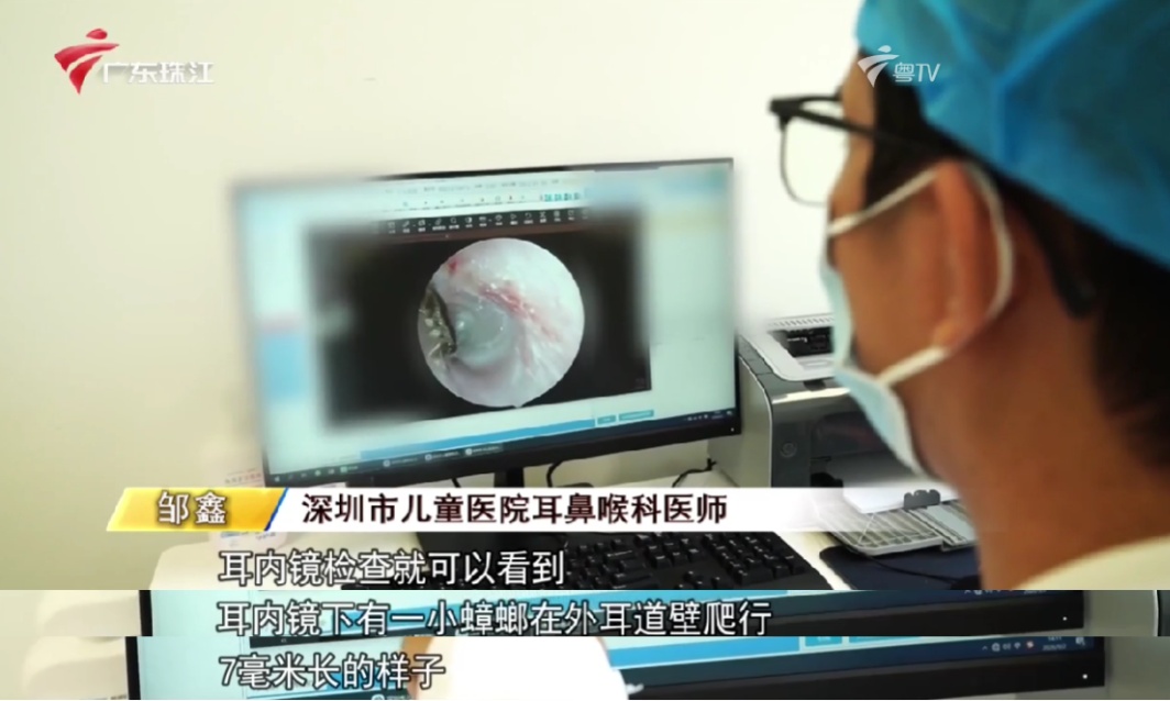“活的！还在爬！”14岁男孩凌晨睡梦中被剧痛惊醒，耳内竟藏活蟑螂