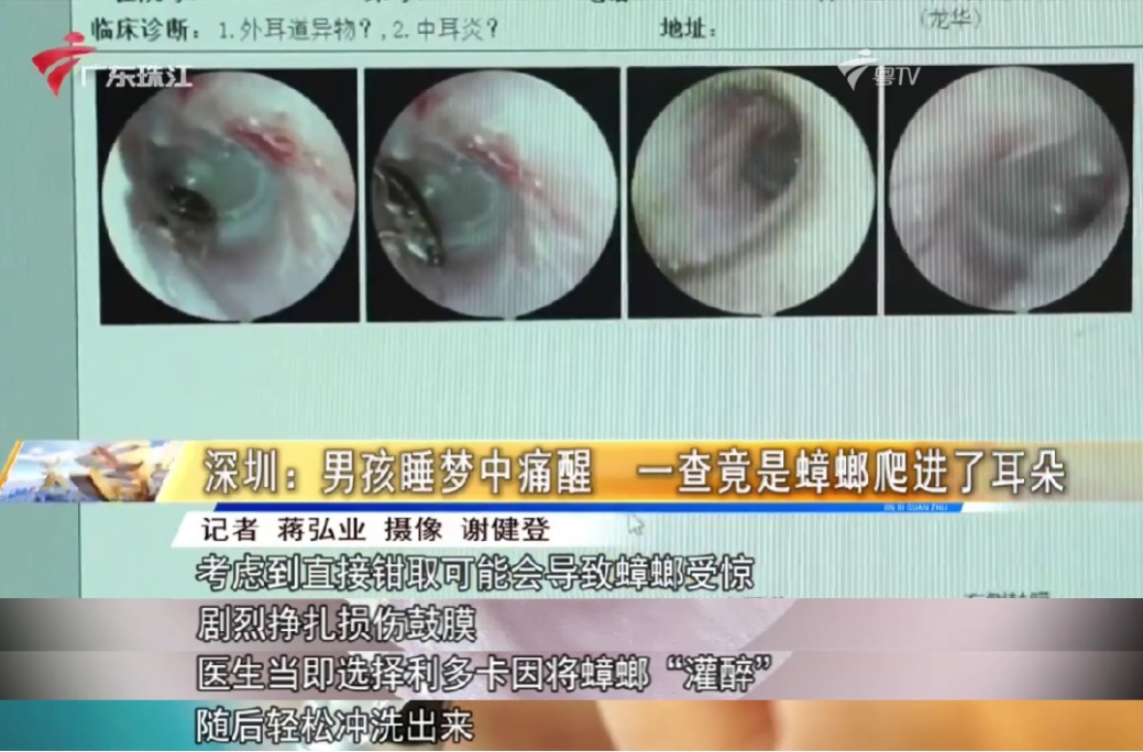 “活的！还在爬！”14岁男孩凌晨睡梦中被剧痛惊醒，耳内竟藏活蟑螂