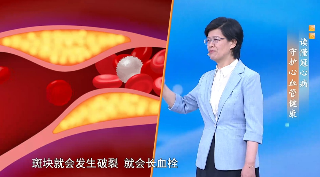 心梗不一定只表现为胸痛！认清这5类异常表现，关键时刻能救命！