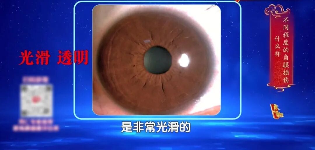 一个毁掉视力的习惯，你可能天天做，两个小动作帮你减少眼部损伤