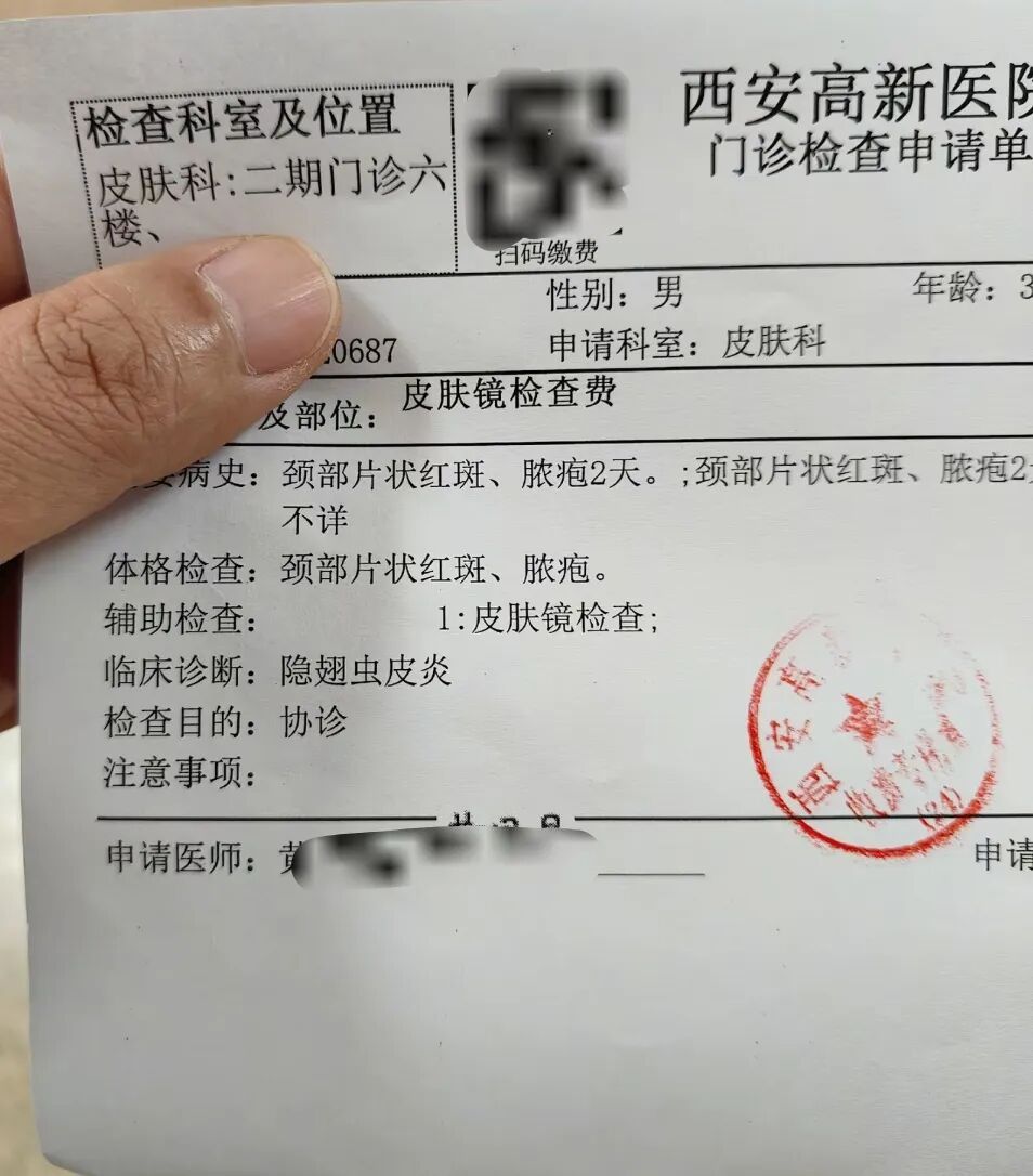 陕西多地发现隐翅虫！遇到这种“飞行的硫酸”，千万别拍