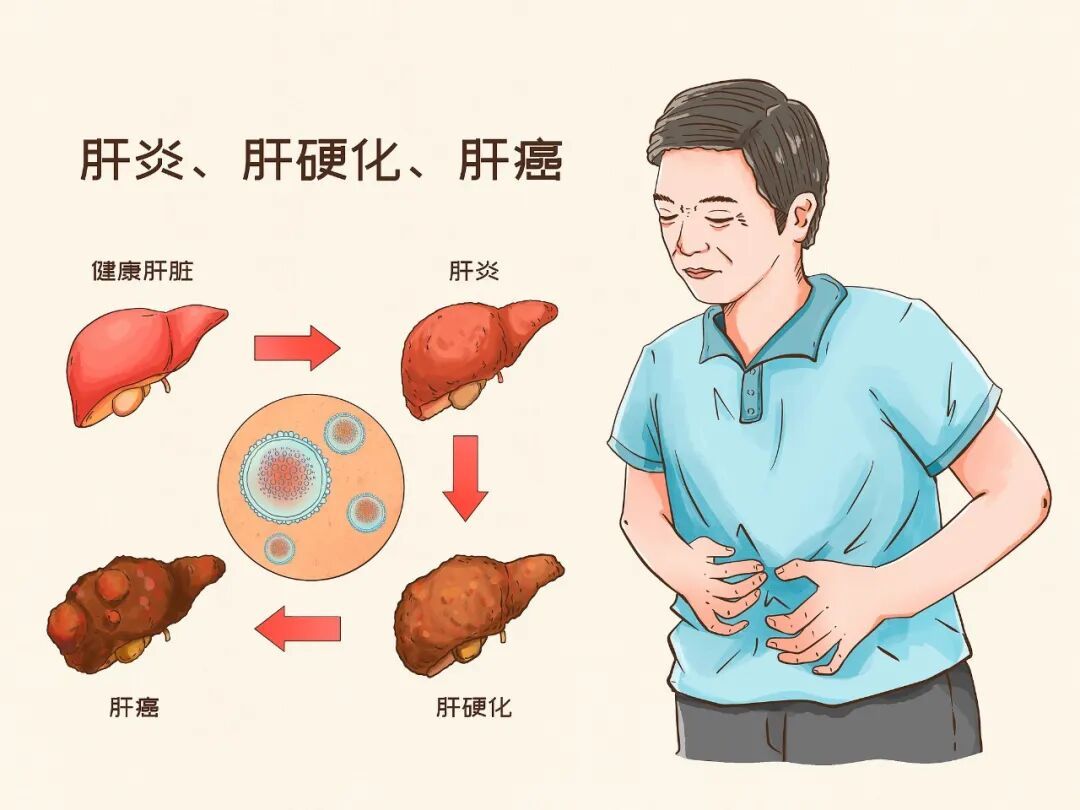 30岁以上别忽略!不少人没查过乙肝抗体,乙肝是肝癌高危因素,抽空做个检测吧 30岁以上别忽略!不少人没查过乙肝抗体,乙肝是肝癌高危因素,抽空做个检测吧