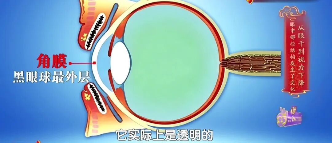 一个毁掉视力的习惯，你可能天天做，两个小动作帮你减少眼部损伤