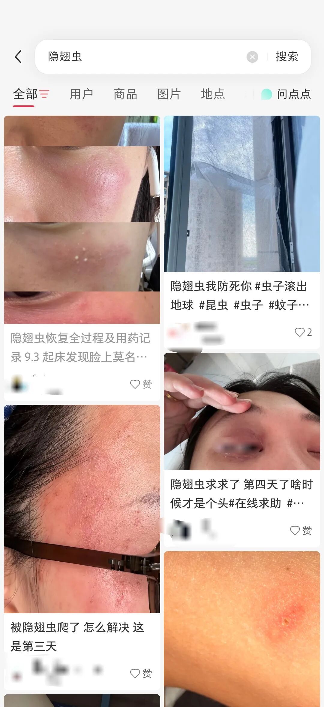 陕西多地发现隐翅虫！遇到这种“飞行的硫酸”，千万别拍