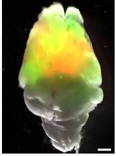 人脑类器官“长进”鼠脑！但比技术进展更迫切的是→