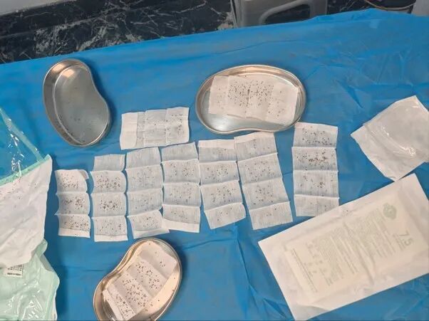 男子遭群蜂“围堵”，急诊3人拔刺小组鏖战3小时，拔除千根毒刺！
