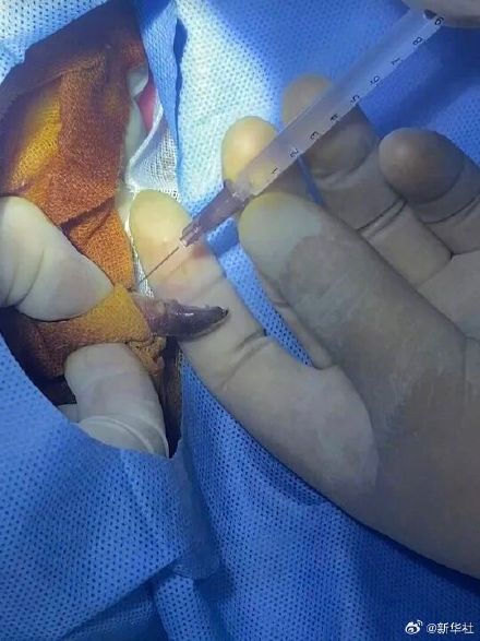 全球首例给歪脸大熊猫整牙