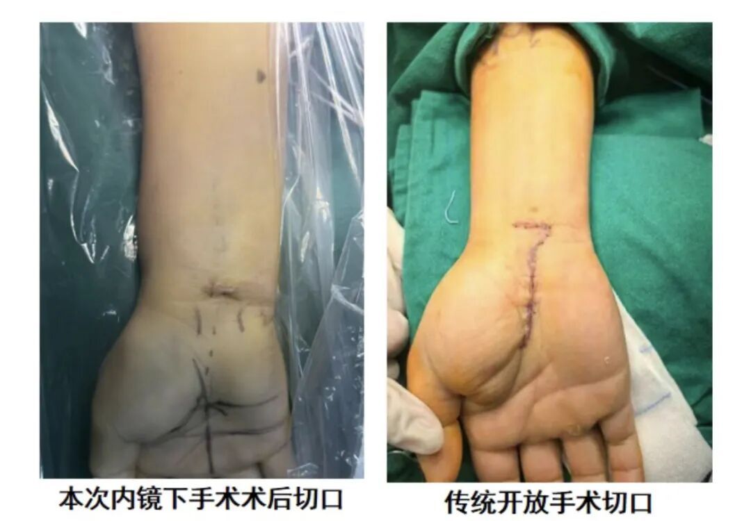 又麻又痛!福州一女子确诊!医生:这病别拖! 又麻又痛!福州一女子确诊!医生:这病别拖!