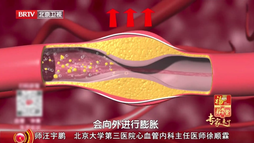 心梗的4个“伪装信号”,很多人到最后一刻才知道(不是胸痛) 心梗的4个“伪装信号”,很多人到最后一刻才知道(不是胸痛)