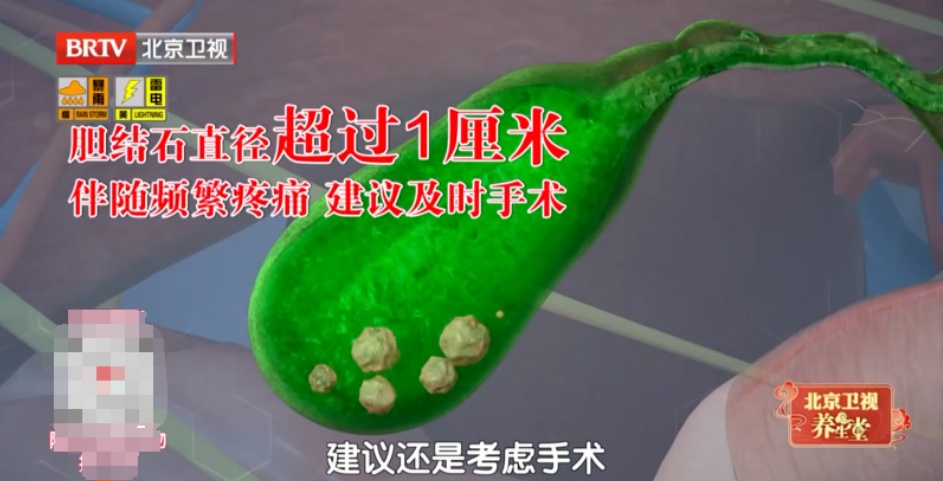 比胃癌更凶的“新晋癌王”，3个吃饭习惯再不改就晚了，尤其女性