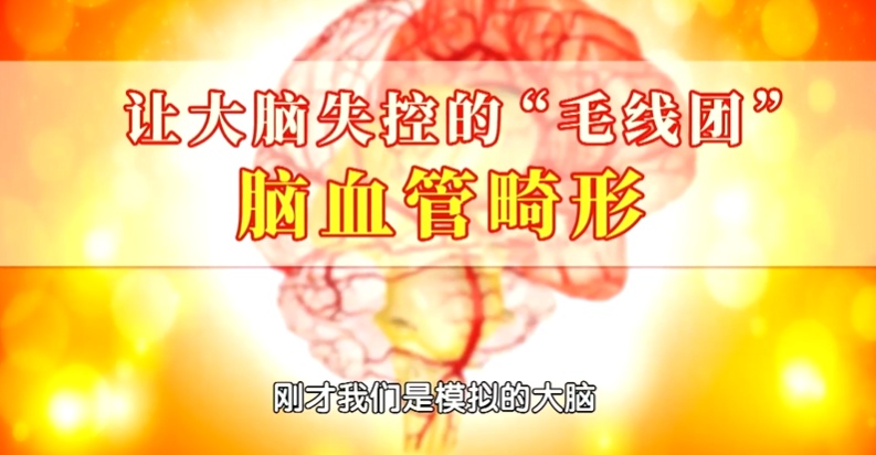 吃饱就困,当心是脑血管被“引爆”,别只当晕碳,3种表现,占得越多越危险 吃饱就困,当心是脑血管被“引爆”,别只当晕碳,3种表现,占得越多越危险