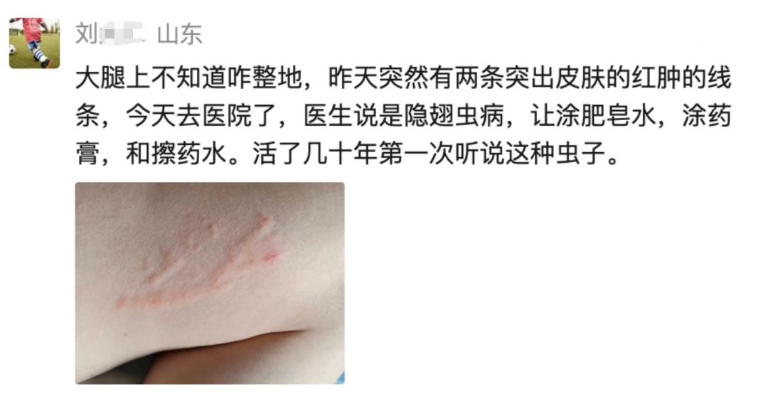 注意！这只“硫酸虫”最怕你“手快”！正确处理只要2步