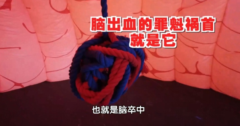 吃饱就困,当心是脑血管被“引爆”,别只当晕碳,3种表现,占得越多越危险 吃饱就困,当心是脑血管被“引爆”,别只当晕碳,3种表现,占得越多越危险