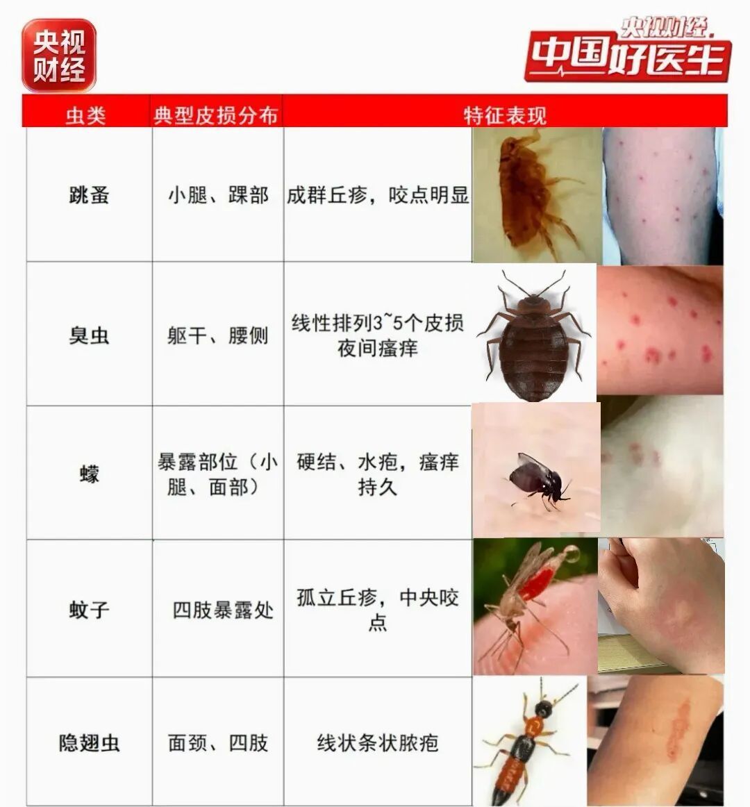 注意！这只“硫酸虫”最怕你“手快”！正确处理只要2步