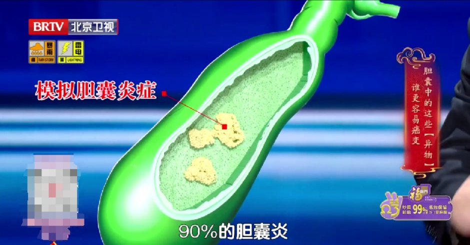 比胃癌更凶的“新晋癌王”，3个吃饭习惯再不改就晚了，尤其女性