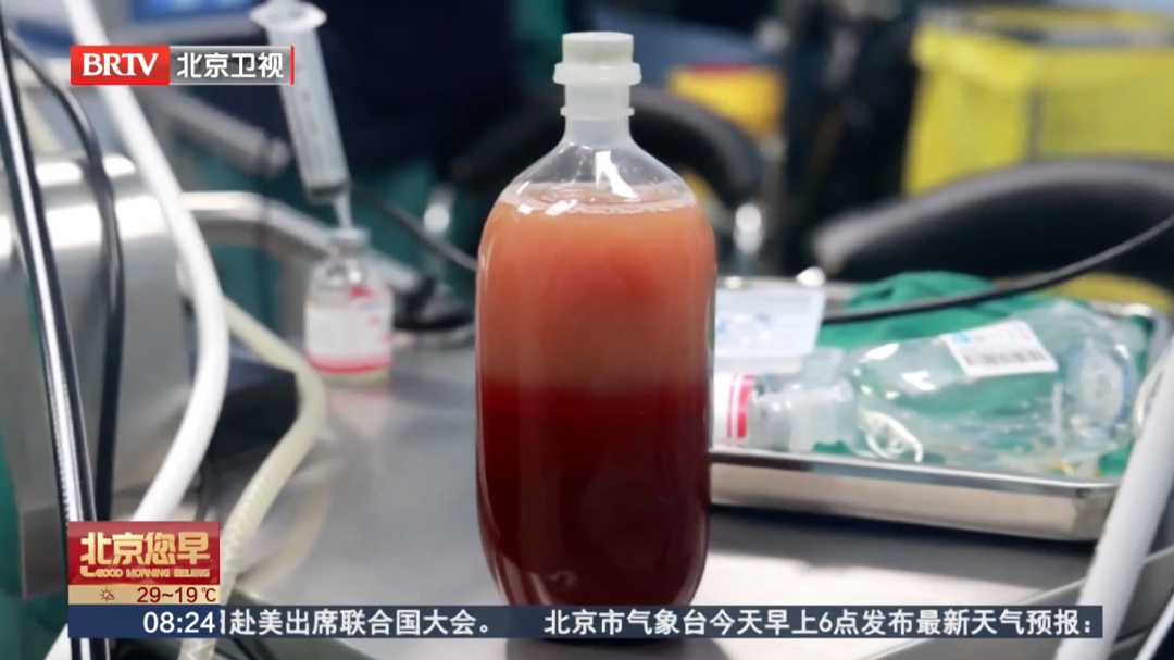 背痛硬扛,男子突然晕倒,心肌竟大面积坏死!医生提醒:7种疼痛是心脏在求救 背痛硬扛,男子突然晕倒,心肌竟大面积坏死!医生提醒:7种疼痛是心脏在求救