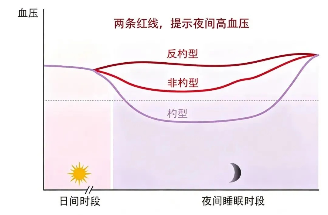 很多脑梗发生在熟睡中,睡前一个小习惯能救命 很多脑梗发生在熟睡中,睡前一个小习惯能救命