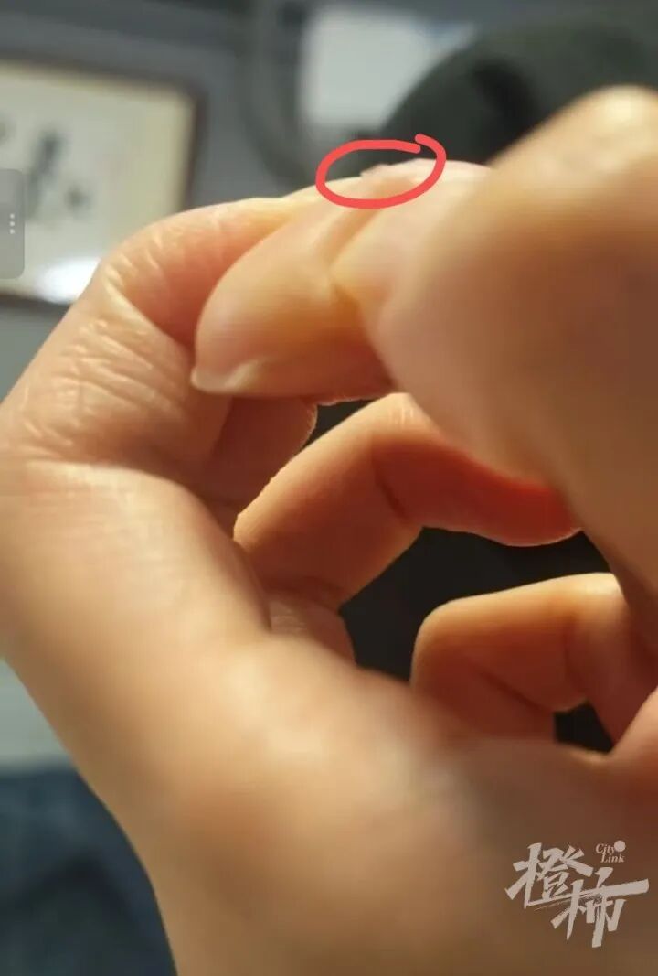 手机贴膜竟成“暗器”?多人手指被扎出血,有人被迫切了一块肉!这种膜赶紧换 手机贴膜竟成“暗器”?多人手指被扎出血,有人被迫切了一块肉!这种膜赶紧换