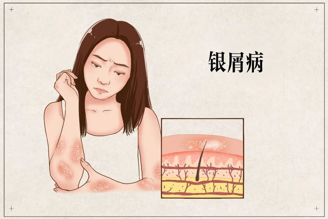 秋风起，青少年皮肤护理这样做