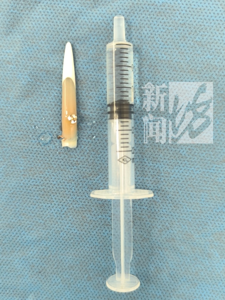 “晚上翻身撕裂,疼得钻心!”有人鲜血直流,这两天门诊量急增,医生提醒 “晚上翻身撕裂,疼得钻心!”有人鲜血直流,这两天门诊量急增,医生提醒