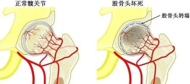 刘欢离世前曾隐瞒病情，多年前确诊，专家：这个病早期没症状，出现3个信号要警惕