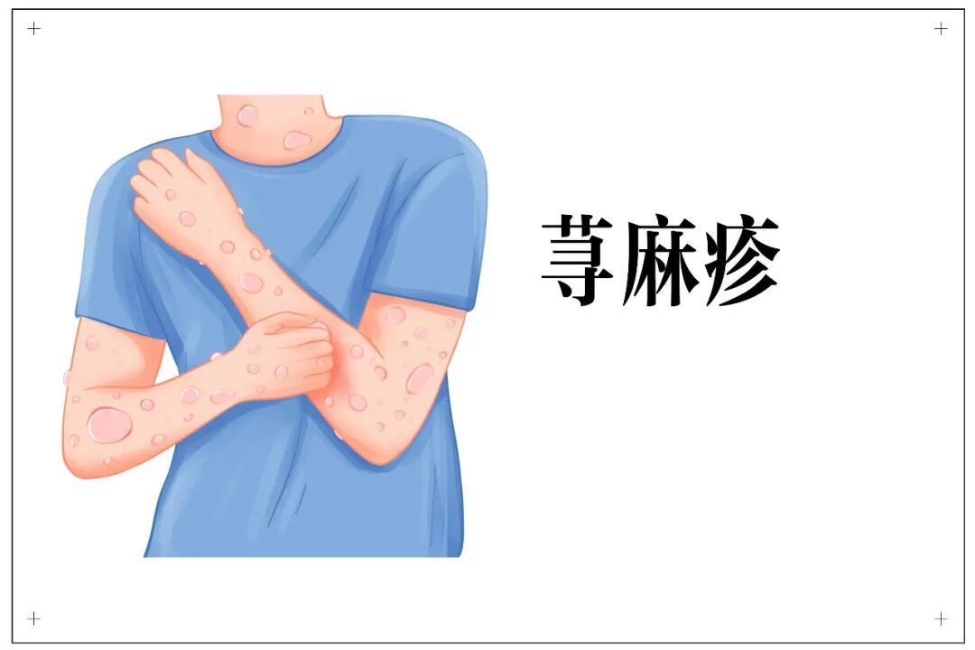秋风起，青少年皮肤护理这样做
