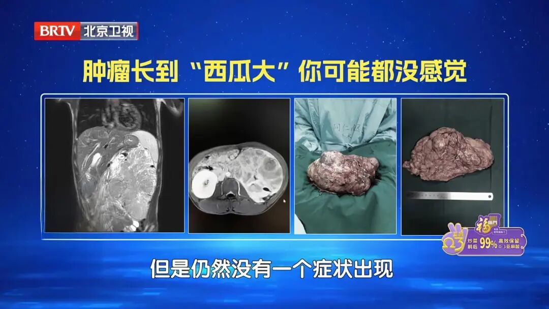 不痛不痒,一查竟是癌?血压有这个特点是信号,40岁以上尽快查 不痛不痒,一查竟是癌?血压有这个特点是信号,40岁以上尽快查
