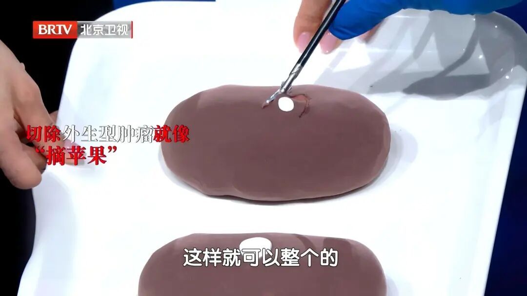 不痛不痒,一查竟是癌?血压有这个特点是信号,40岁以上尽快查 不痛不痒,一查竟是癌?血压有这个特点是信号,40岁以上尽快查