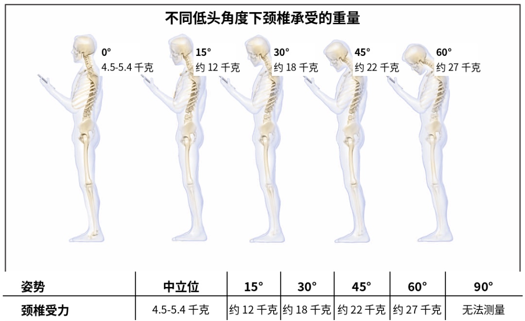 快停下,再这么刷手机,脖子要扛不住啦! 快停下,再这么刷手机,脖子要扛不住啦!
