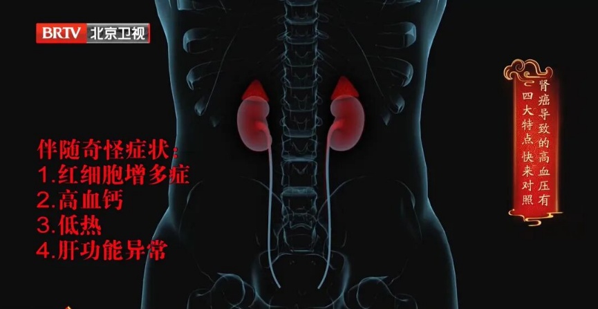 不痛不痒,一查竟是癌?血压有这个特点是信号,40岁以上尽快查 不痛不痒,一查竟是癌?血压有这个特点是信号,40岁以上尽快查