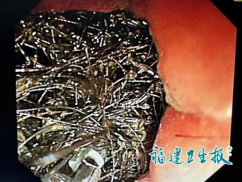 警惕 | 12岁女孩总喊肚子疼！医生一查傻眼！家长极易忽视……