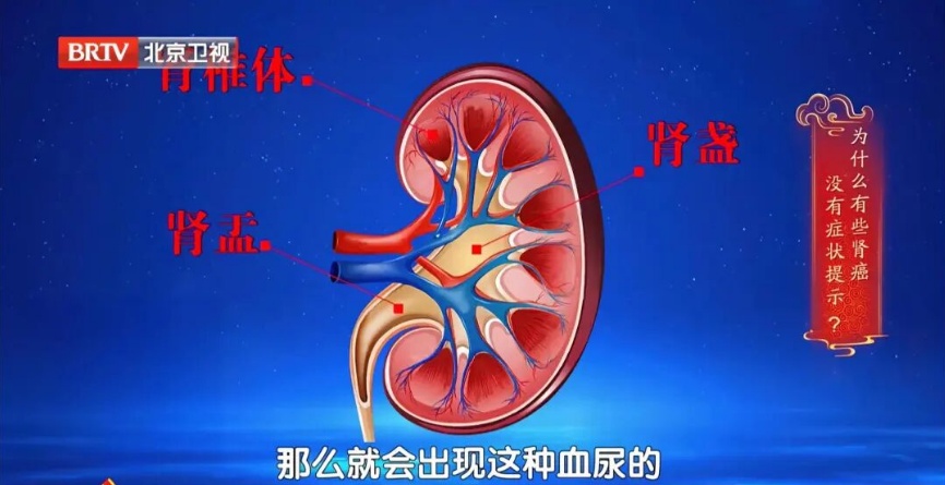 不痛不痒,一查竟是癌?血压有这个特点是信号,40岁以上尽快查 不痛不痒,一查竟是癌?血压有这个特点是信号,40岁以上尽快查