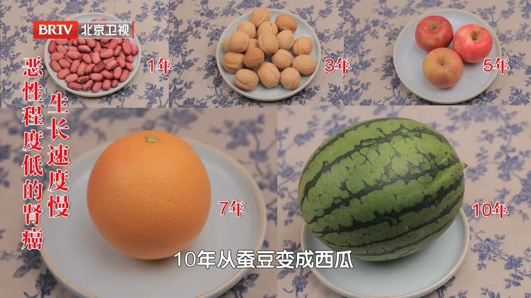 不痛不痒,一查竟是癌?血压有这个特点是信号,40岁以上尽快查 不痛不痒,一查竟是癌?血压有这个特点是信号,40岁以上尽快查