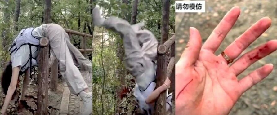 女子模仿网红姿势拍照不慎摔下山坡！别再这样拍照了