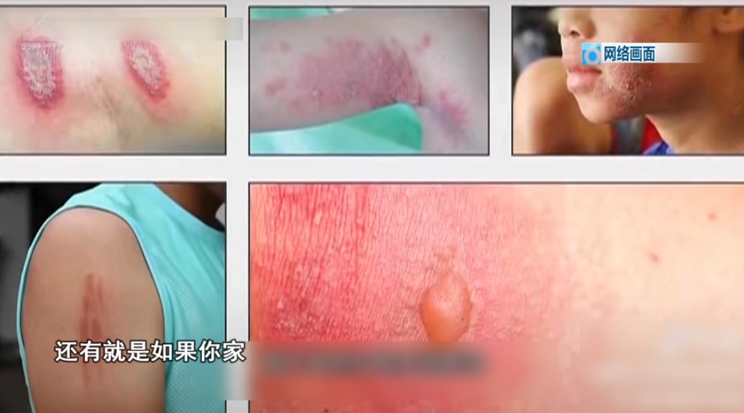 千万别碰！昆明已有人中招，专家提醒……