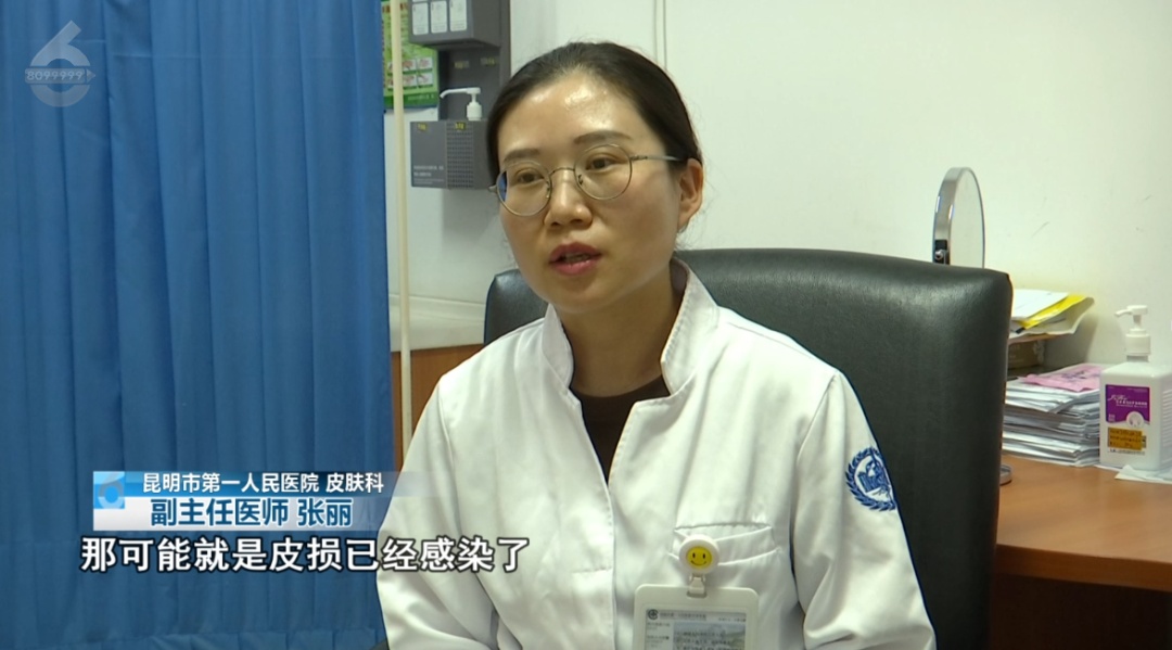 千万别碰！昆明已有人中招，专家提醒……