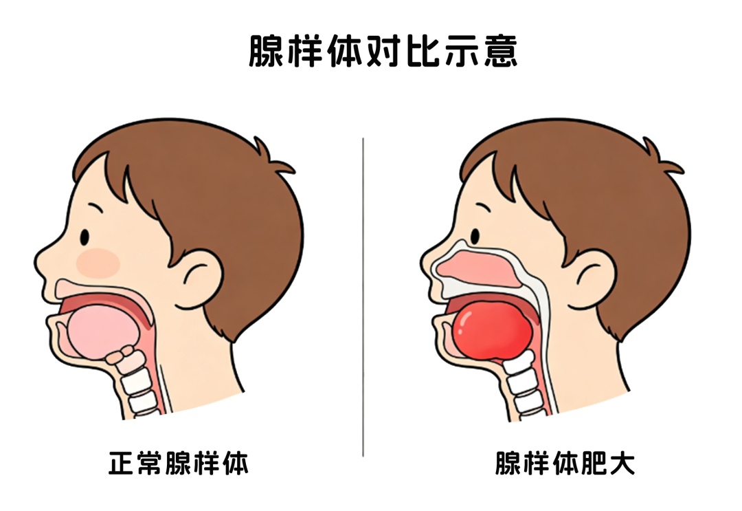 杭州有人一口气吃20个橘子,竟整夜喘不过气!送医一查...... 杭州有人一口气吃20个橘子,竟整夜喘不过气!送医一查......