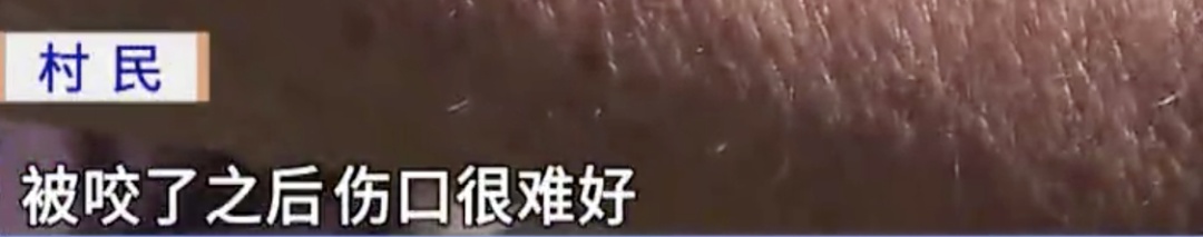 “咬了很多次”!韶关一村出现大量红火蚁,不少村民被咬伤…… “咬了很多次”!韶关一村出现大量红火蚁,不少村民被咬伤……