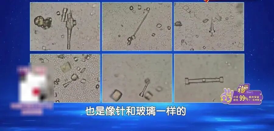 心血管“淤堵”的元凶,原来就藏在你家的餐桌上…(不是脂肪) 心血管“淤堵”的元凶,原来就藏在你家的餐桌上…(不是脂肪)