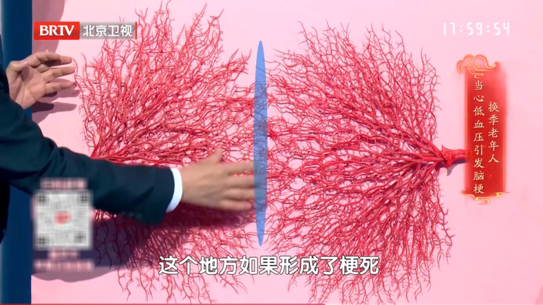 58岁男子这样洗澡，险些没命！医生提醒：不想脑梗找上门，5个危险因素一个都别沾