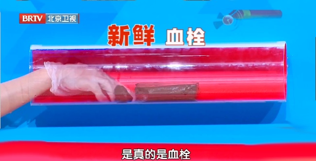 上厕所别超过这个时间,长痔疮都算轻的,严重可诱发心脏骤停… 上厕所别超过这个时间,长痔疮都算轻的,严重可诱发心脏骤停…