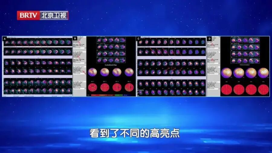 出现这种“累”，是心脏在“求救”，光靠休息没用，正确做法是…