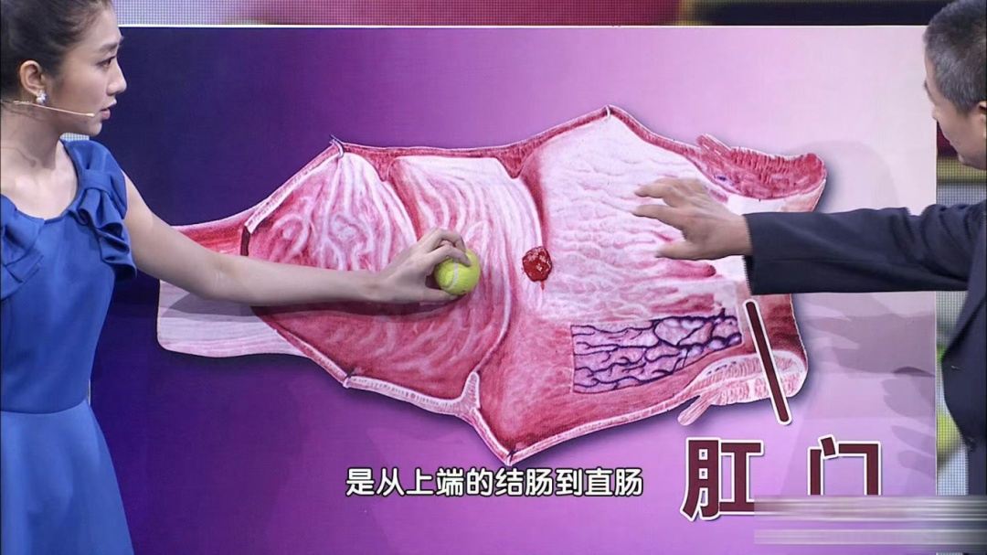上厕所别超过这个时间,长痔疮都算轻的,严重可诱发心脏骤停… 上厕所别超过这个时间,长痔疮都算轻的,严重可诱发心脏骤停…