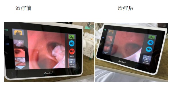 上海瑞金医院紧急提醒:吃馄饨时要留个心!尤其是这类人群 上海瑞金医院紧急提醒:吃馄饨时要留个心!尤其是这类人群