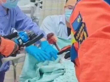 浙江一男子洗澡时滑到,马桶刷直插胸腔!送医急救,医生拨打了119…… 浙江一男子洗澡时滑到,马桶刷直插胸腔!送医急救,医生拨打了119……